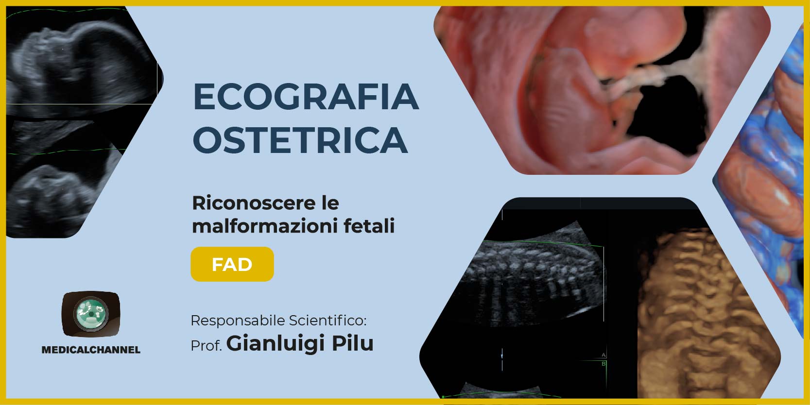 Corso Avanzato di Ecografia Ostetrica: riconoscere le Malformazioni Fetali